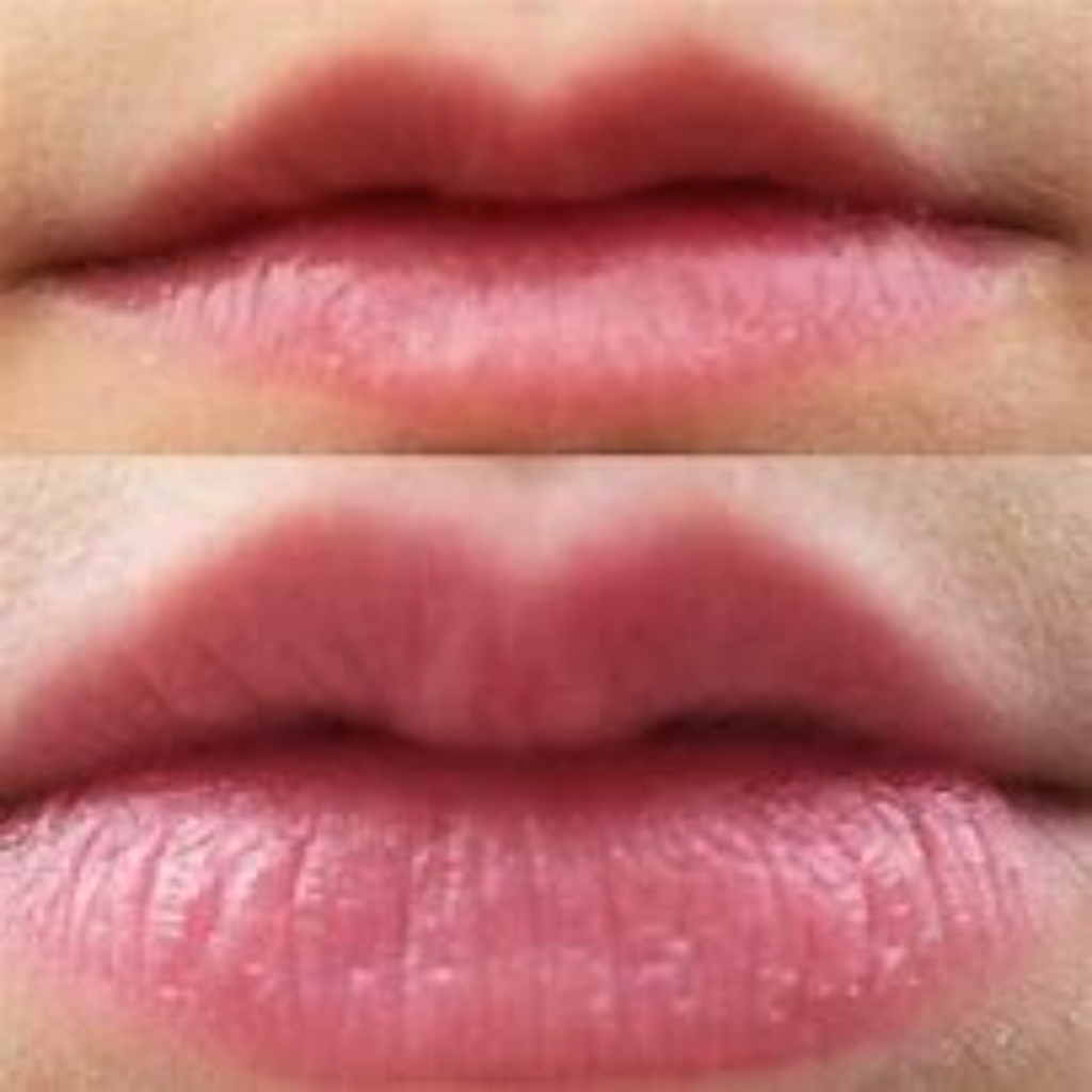 Seraphine Lips™ Electric Lip Vacuum Plumper